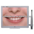 Dental Endoscope system,Dental Endoscopic Camera